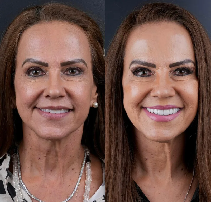 Transformação dental — Instagram