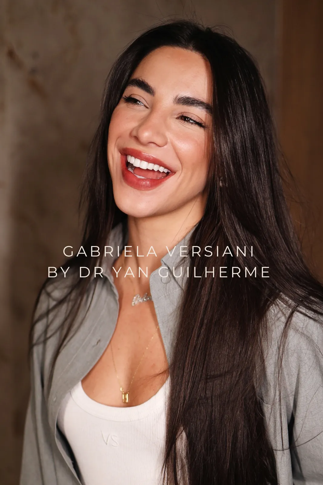 Resultado de lentes de porcelana — sorriso Dr. Yan Guilherme