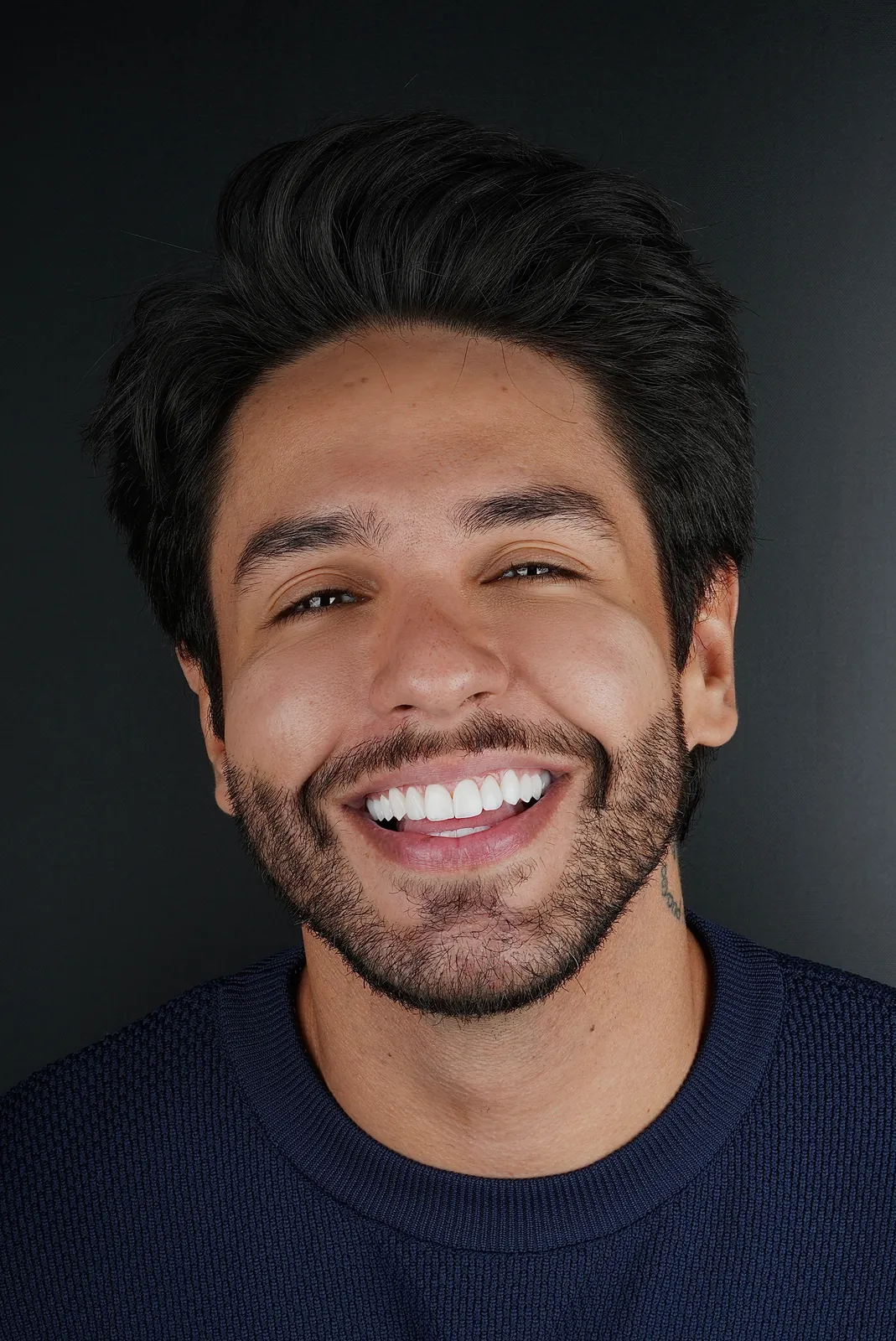 Transformação dental — lentes de porcelana