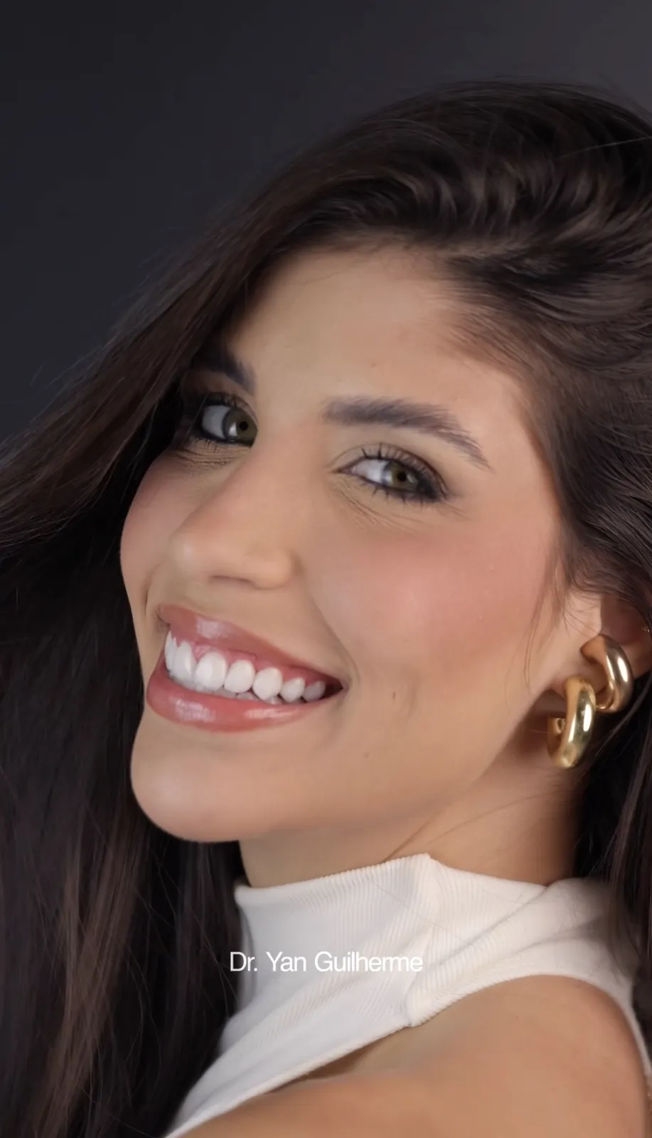 Transformação dental — lentes de porcelana