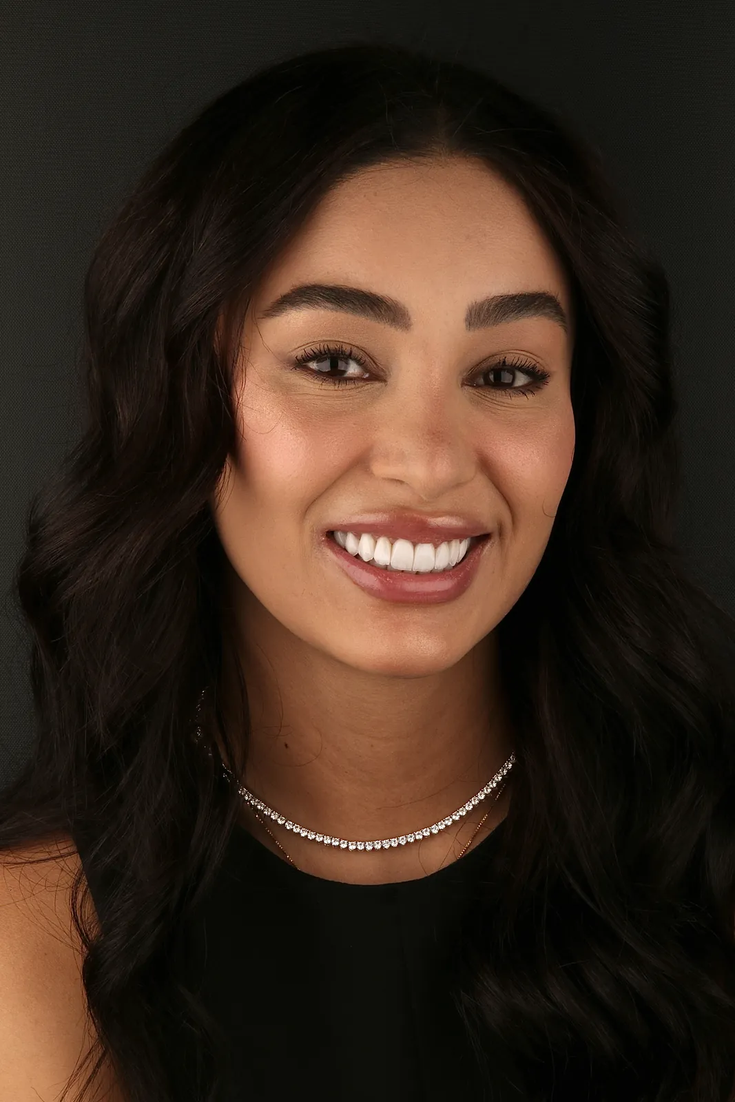 Transformação dental — lentes de porcelana